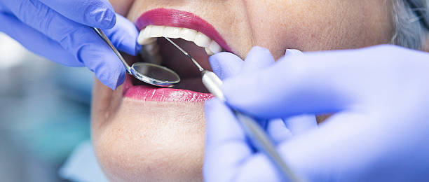 Best Emergency Tooth Extraction in Deenwood, GA