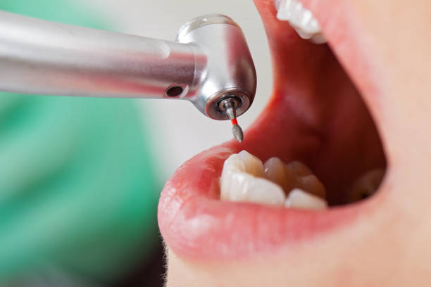 Best Pediatric Emergency Dentist in Deenwood, GA